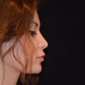 Фото к отзыву о Клиника пластической хирургии "Art Plastic"