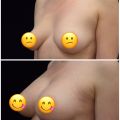 Фото к отзыву о Клиника пластической хирургии "Art Plastic"